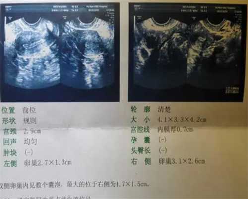 aa69国际助孕_2023
中国代孕,广医