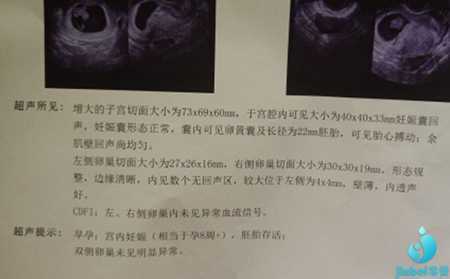 杭州42岁第三代试管婴儿案例_杭州49岁供卵可以用家里人的吗_谁说女人做了试管