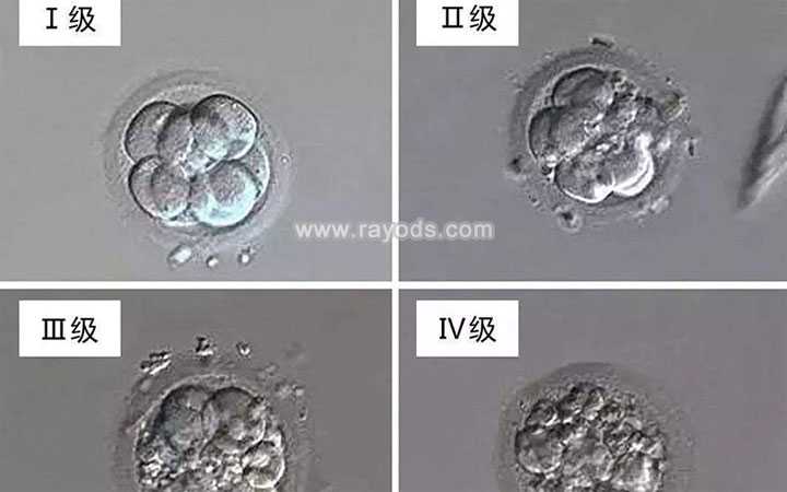 通辽80后借卵怀孕_二代试管培养的胚胎质量怎么样？等级是多少？