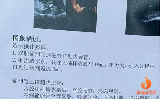 滨州高龄供卵试管成功率_滨州38岁供卵生孩子_做试管婴儿取卵要手术吗？