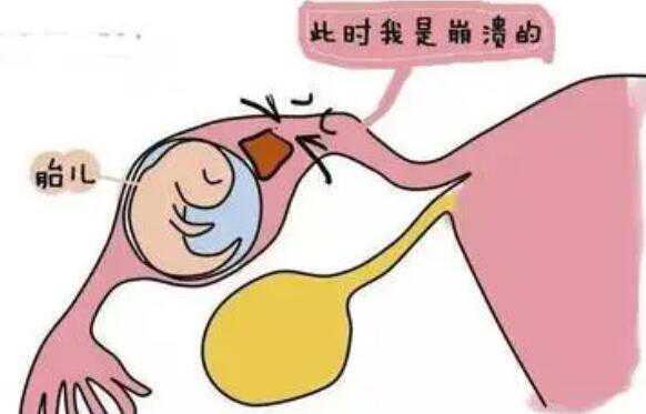 郑州借卵代生中心 郑州有哪些做三代试管男孩的医院? ‘32周双顶径看男女’