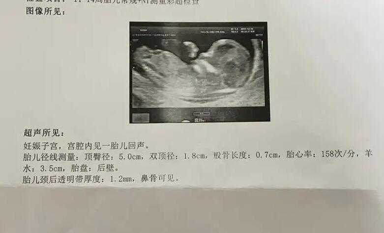 代孕公司安全吗_涿州市医院试管婴儿怎么样，附2023助孕成功率数据参考